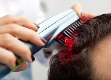 Hair-Regrowth-Therapy