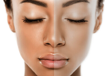 dull-skin-foreo